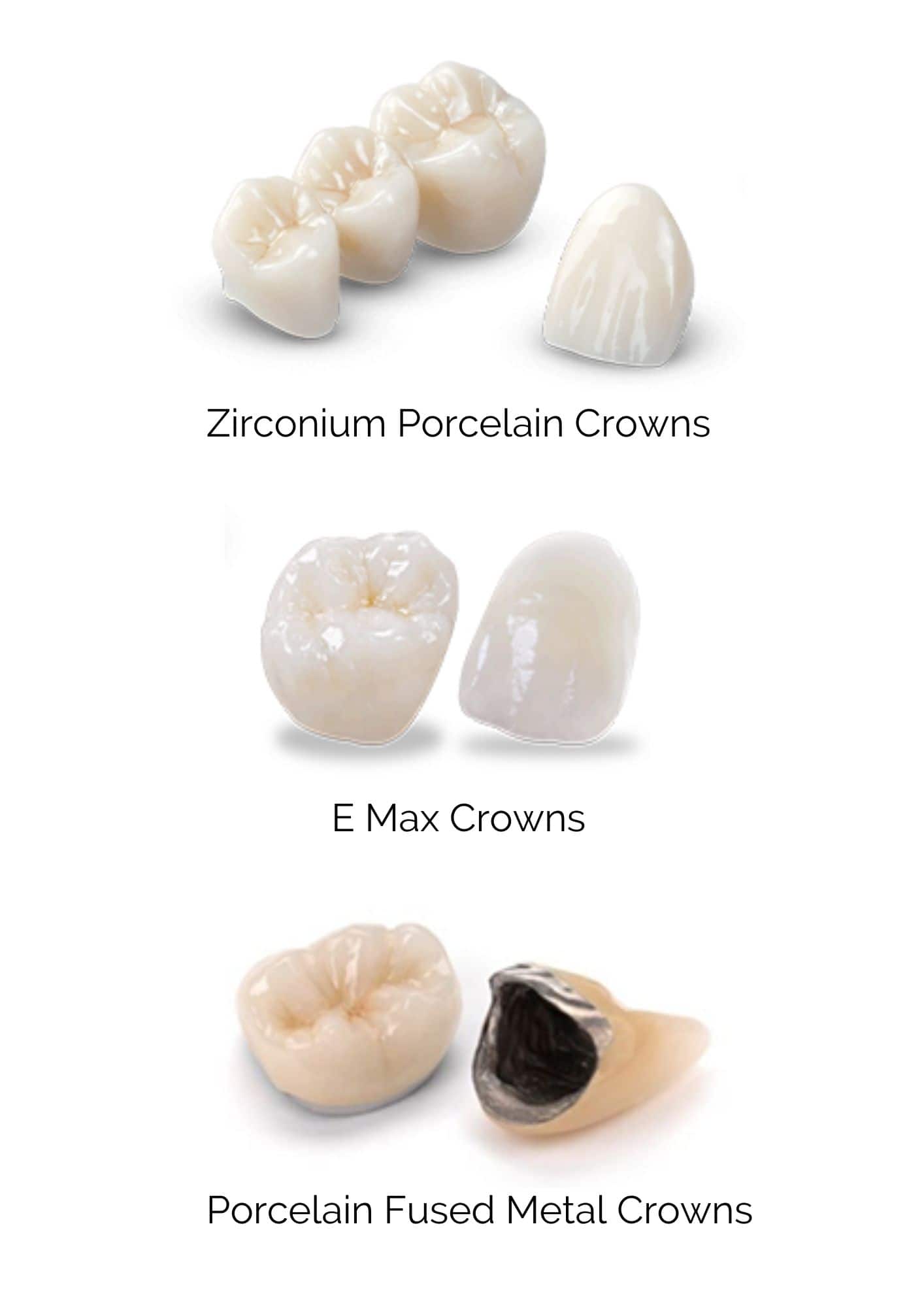 types of dental crowns in Turkey