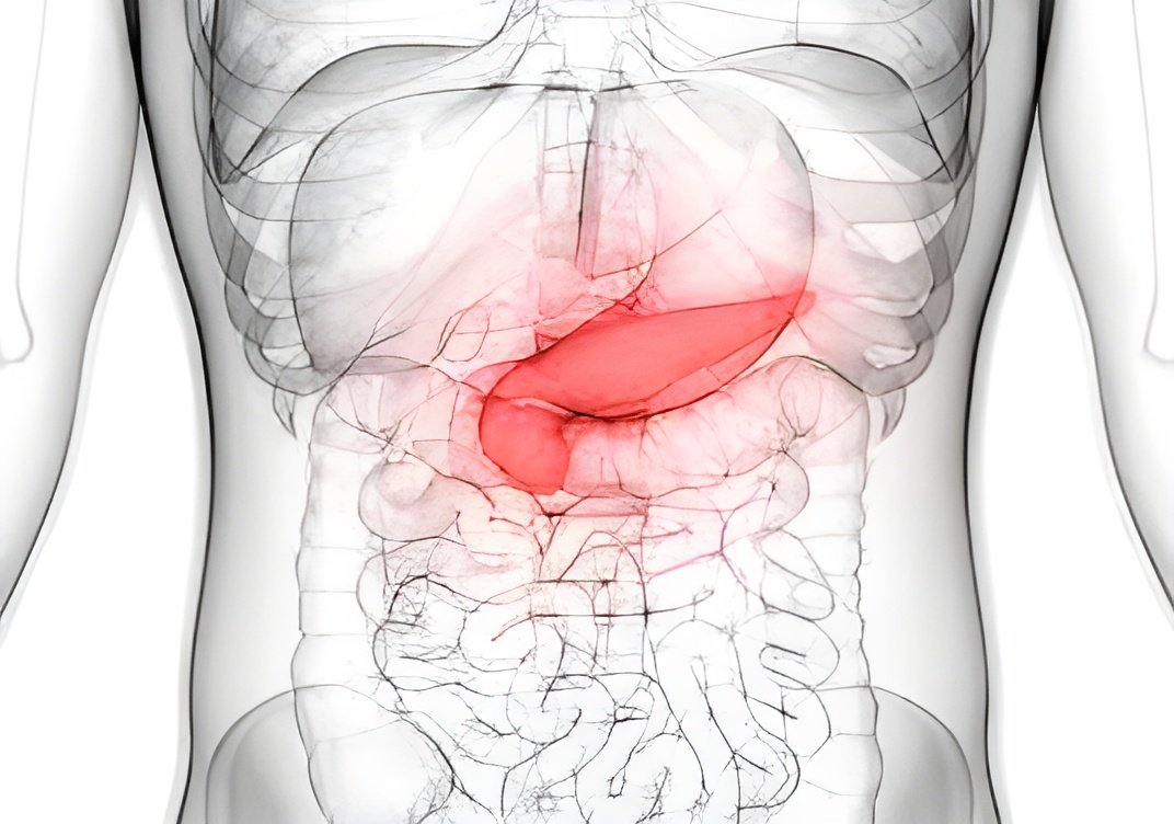symptoms of  pancreatitis diagnosis