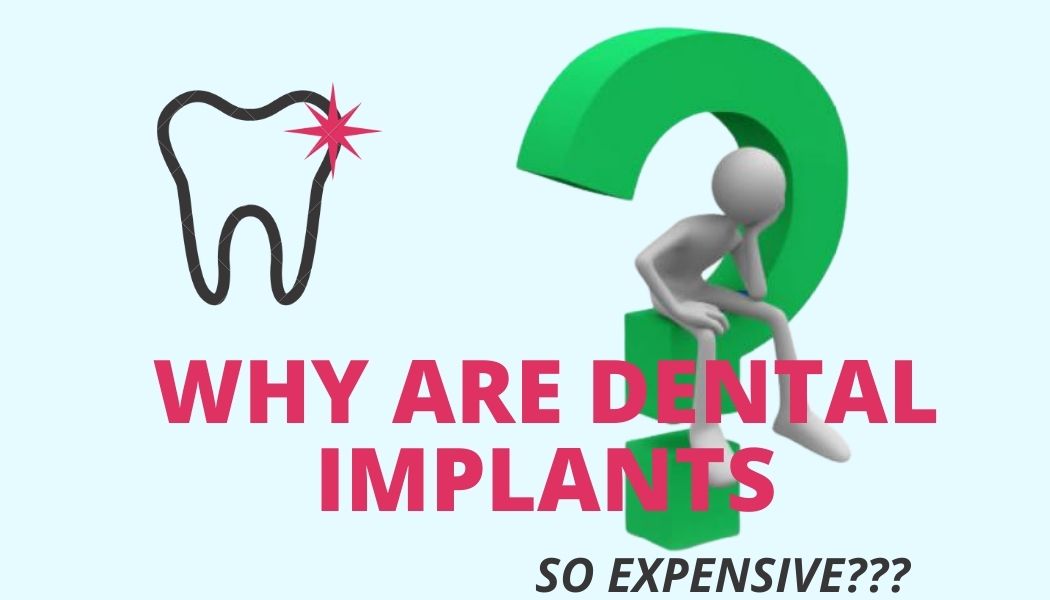 Infographics - thinking man why implants are so expensive, tooth drawing